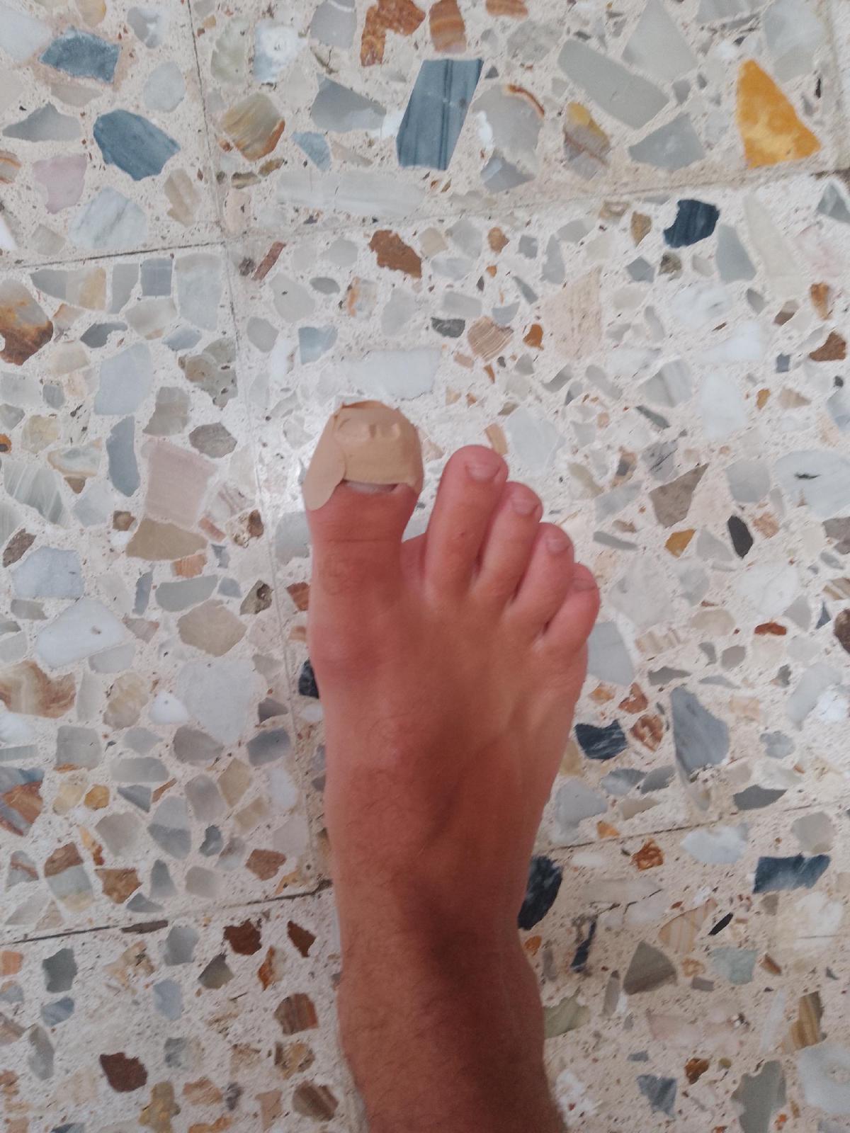 Foot with big toe wrapped in a plaster
