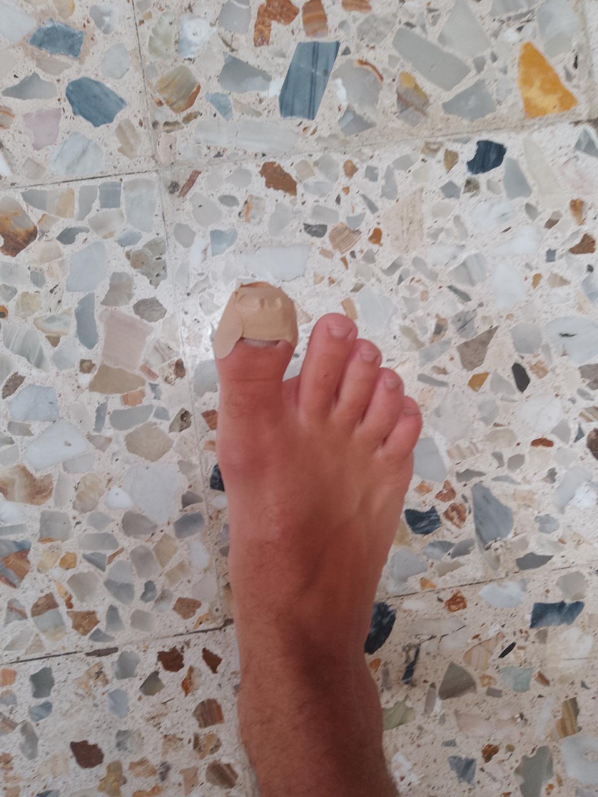 Foot with big toe wrapped in a plaster